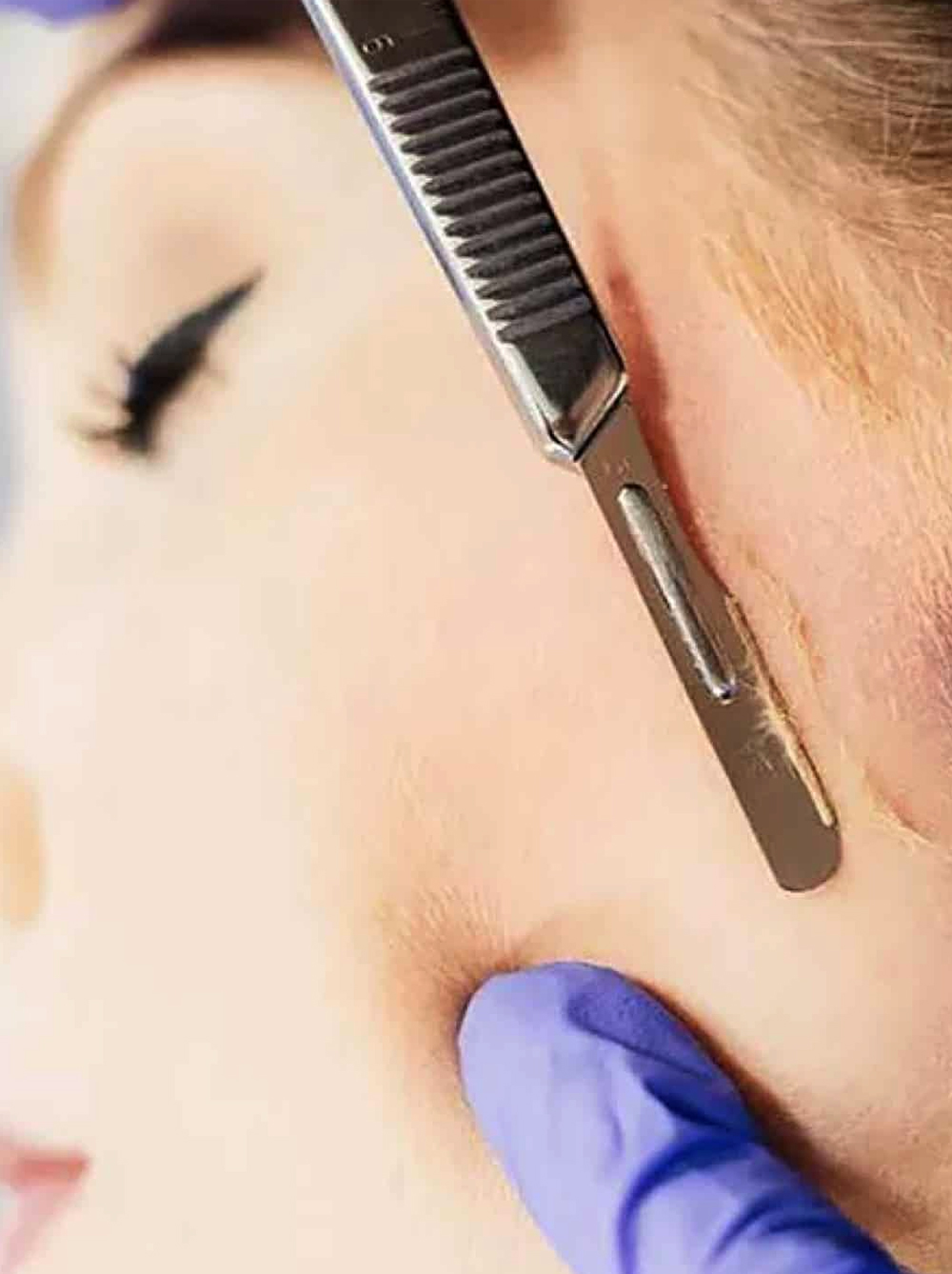 Congested Skin | Aesthetically You