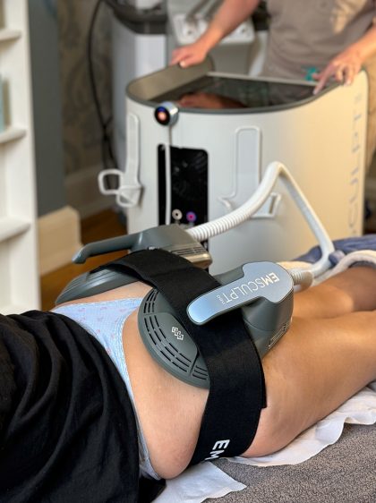 aesthetically-you-treatment-emsculpt